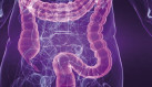colonscopia