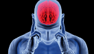 neurologia